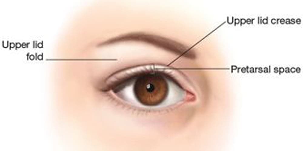 Before and after double eyelid surgery by Dr Peter Kim — featured case 1 Before and after double eyelid surgery by Dr Peter Kim — featured case 1